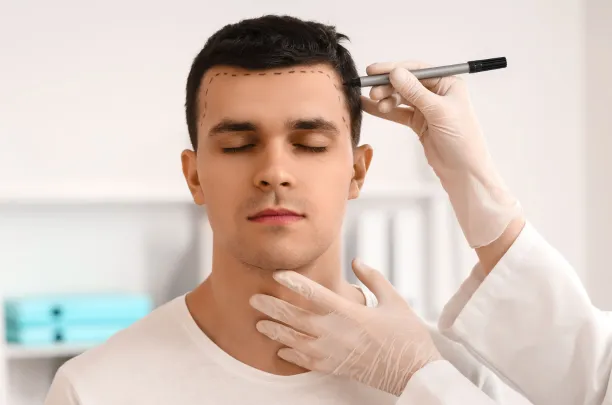 What You Should Know About Hair Loss and When to Get Help