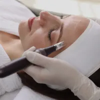 Microneedling Vaughan: A Refined Guide to Smoother, Brighter, Healthier-Looking Skin