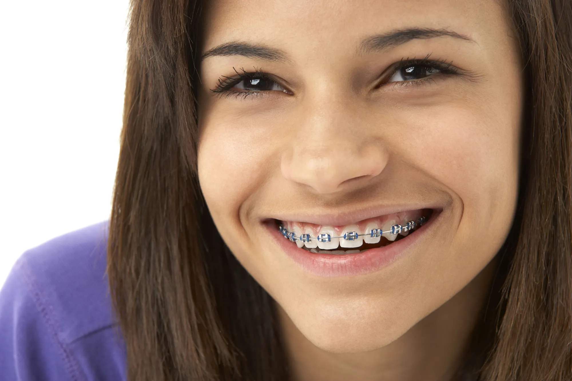 Life With Braces: Tips For Eating, Cleaning, And Staying Comfortable