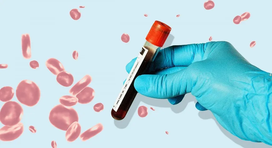 A Comprehensive Guide to Three Types of Skin Allergy Testing