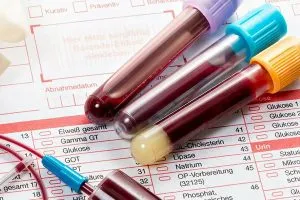 STD Test in Dubai: Expert Clinical Care and Rapid Results