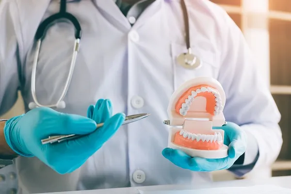 Braces for Adults : Ceramic Braces vs Metal Braces