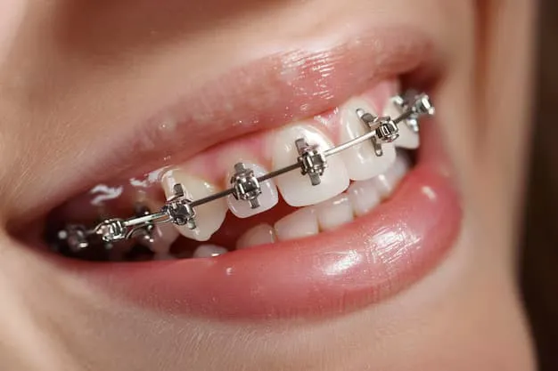 How Braces Burbank Treatments Help Create Confident Smiles