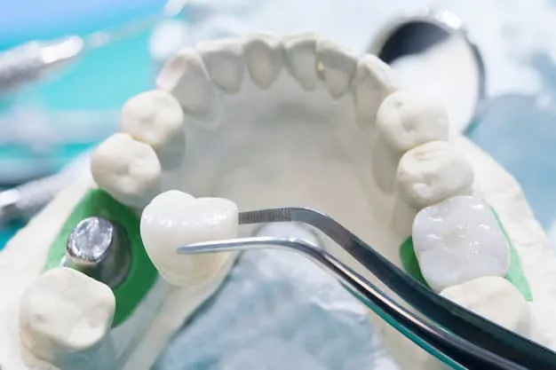 Dental Crowns Beverly Hills for Smile Makeovers