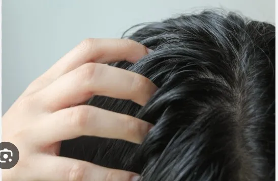 Is oily hair affecting your appearance?