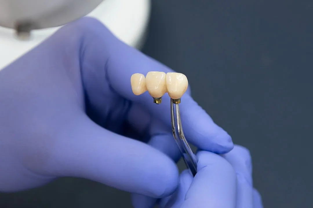 SparX Lab: Reliable Crown and Bridge Dental Lab Services with Fast Turnaround Times