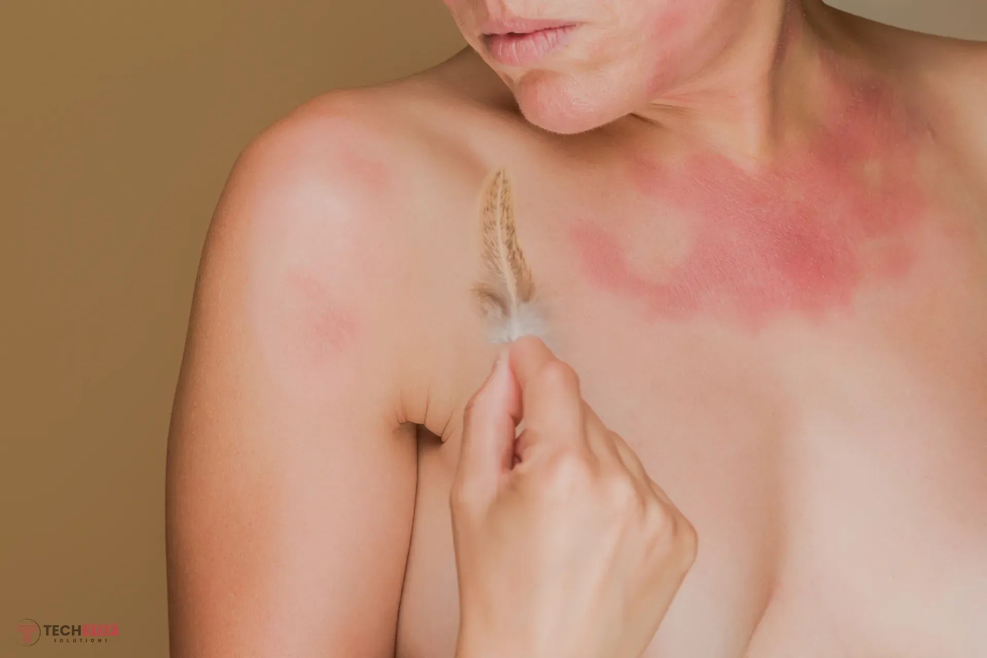 Sun Spot Removal Houston TX for Clearer Skin