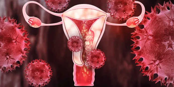 Choosing the Right Hospital for Uterus Cancer Treatment