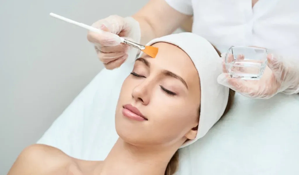 How Chemical Peel Treatment Helps Reduce Pigmentation and Dark Spots
