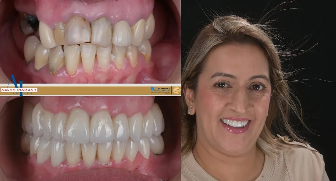 Unhappy with Your Smile? Cosmetic Fixes for Healthy Teeth