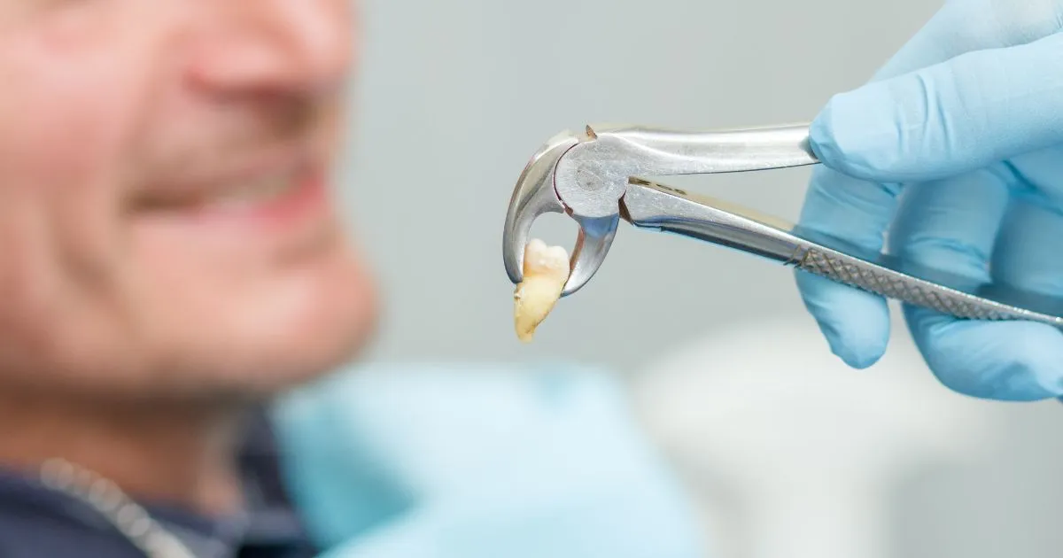 Teeth Extraction in Lahore | Wisdom Tooth and Dental Removal Care