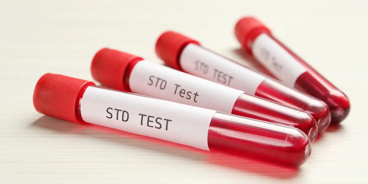STD Test In Dubai: A Smart Step Toward Better Health