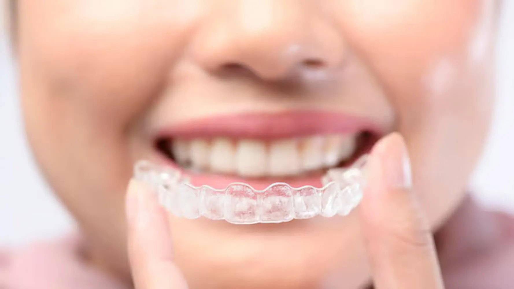 Why Invisalign Clear Braces Are a Popular Choice for Adults