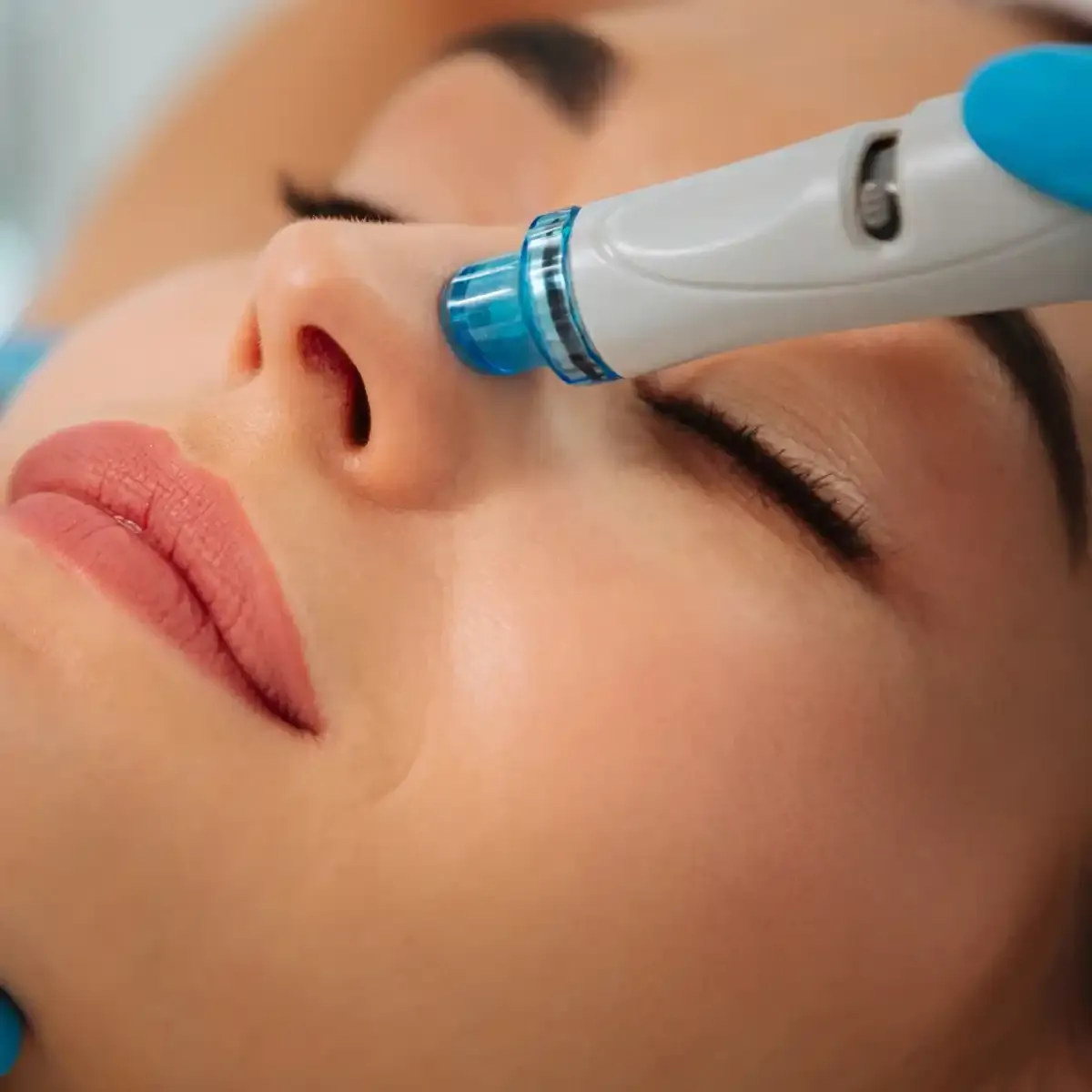 Hydrafacial in Houston for Clearer, Smoother Skin