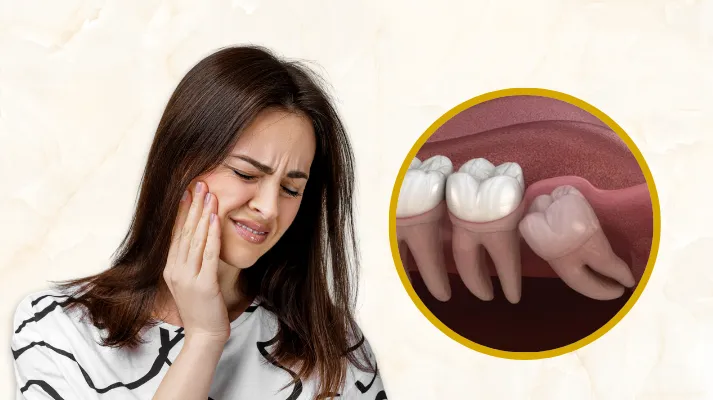Impacted Wisdom Tooth: Symptoms, Risks, and Treatment Options