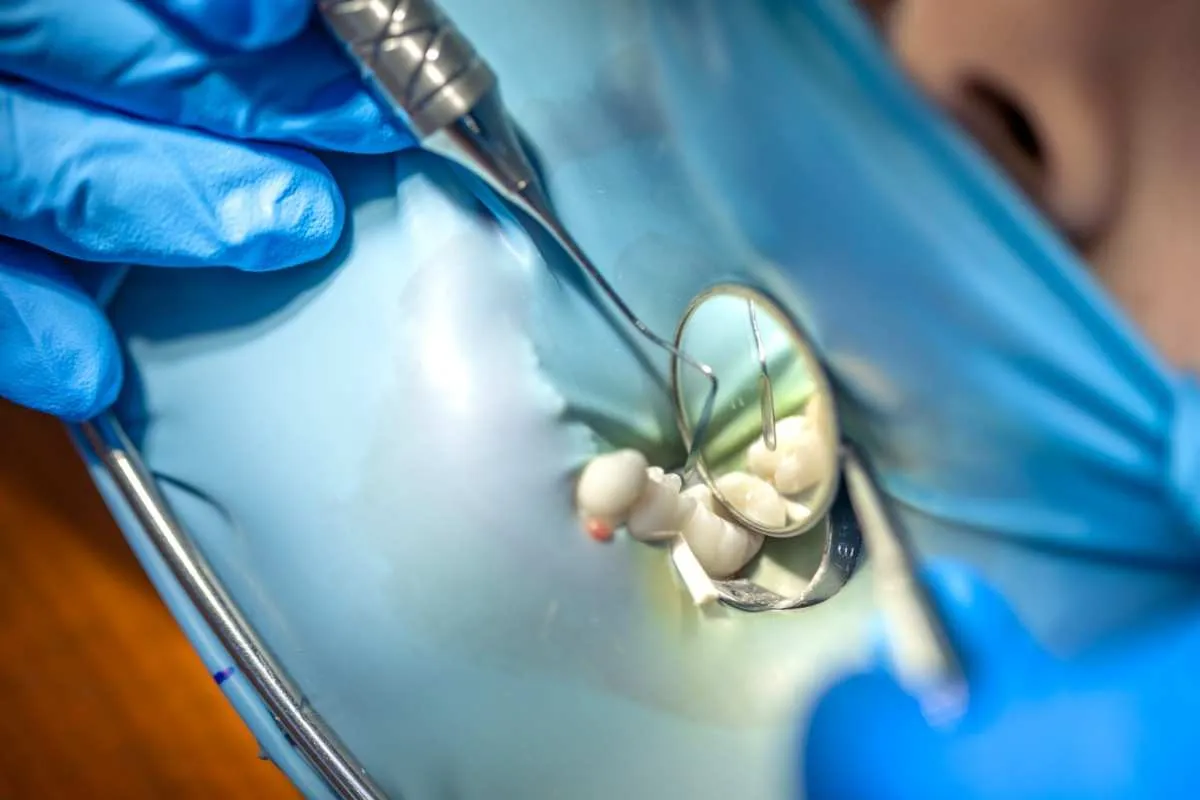 Bone Preservation After Tooth Removal Explained