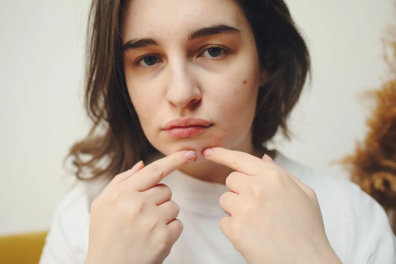 What Happens During a Microneedling Session — And What to Expect After