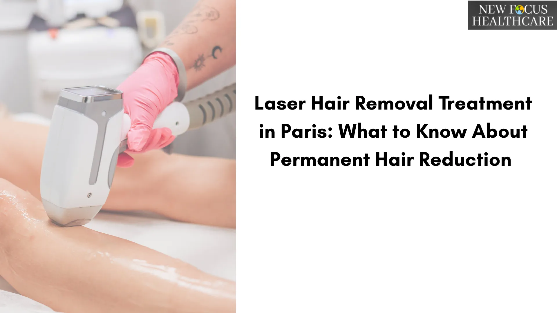 laser hair treatment