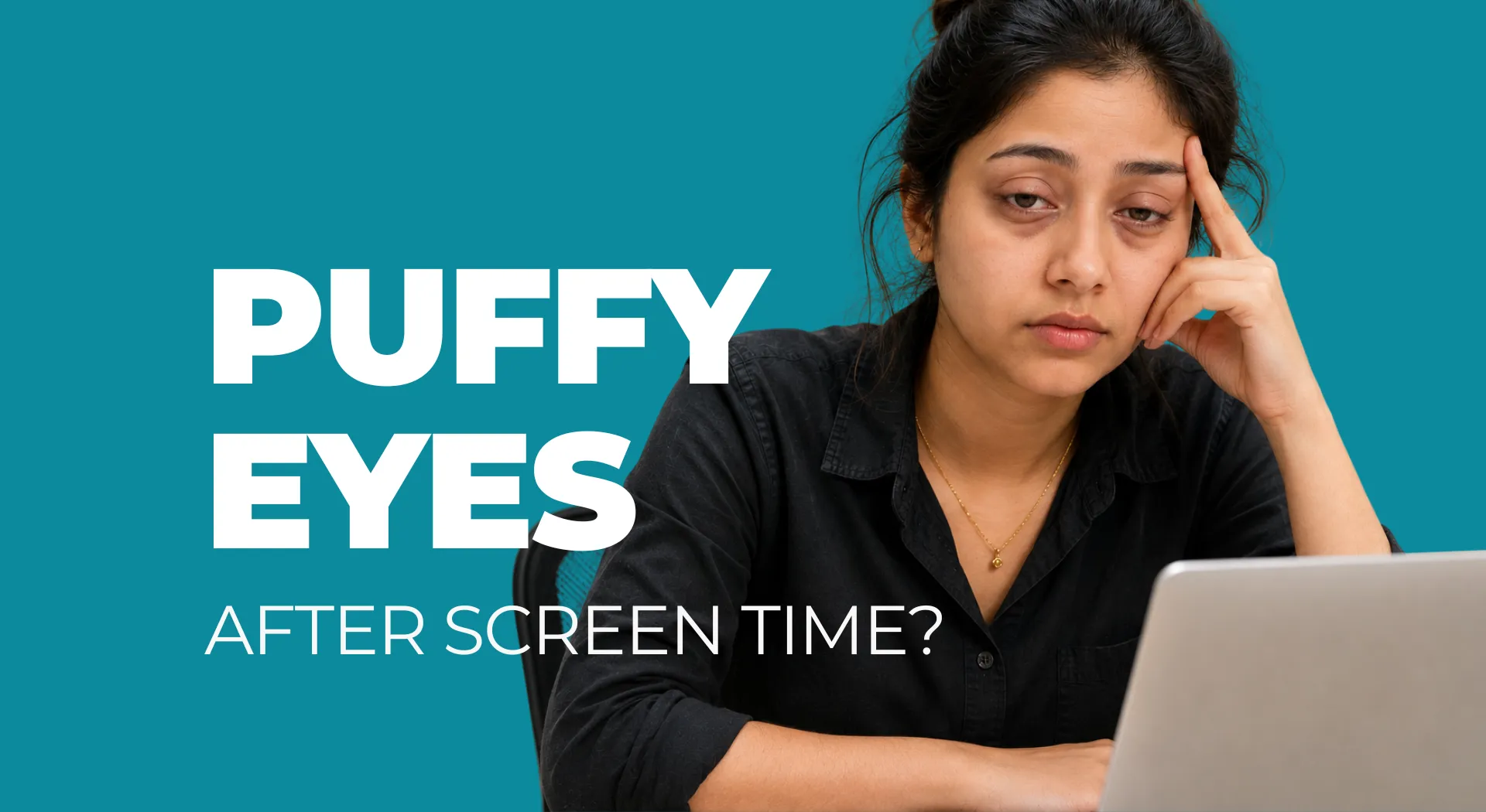 Puffy Eyes After Screen Time: Causes, Care & Best Solutions