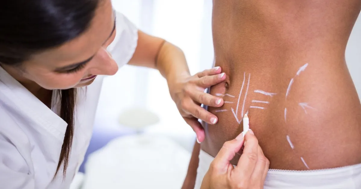 Things To Avoid When Looking For Body Contouring After Liposuction
