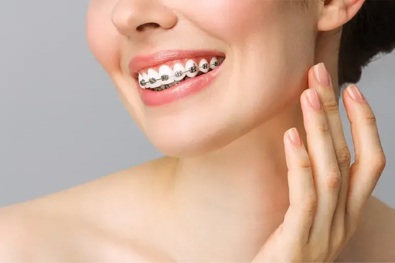 Top Braces Treatment Types Explained: Metal, Ceramic, and Clear Aligners