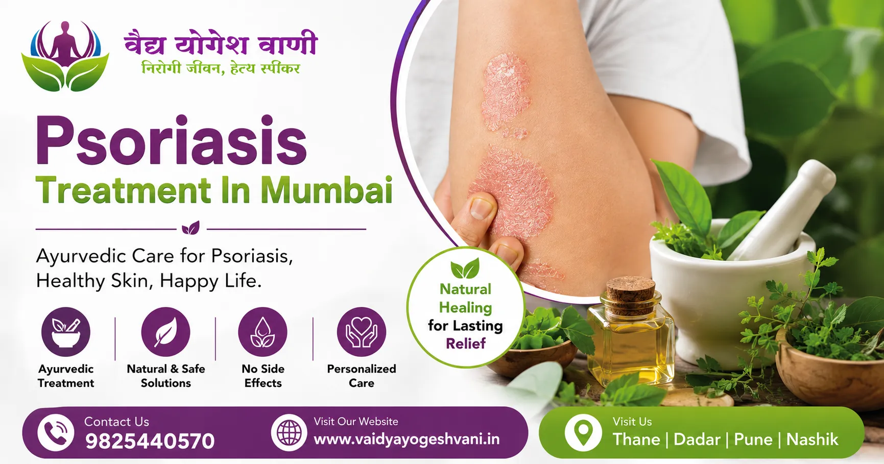 How to Find the Best Psoriasis Treatment In Mumbai Easily