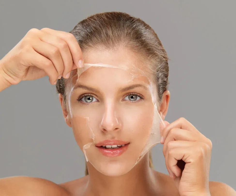 Chemical Peel Treatment for Acne Scars: Benefits and Expectations