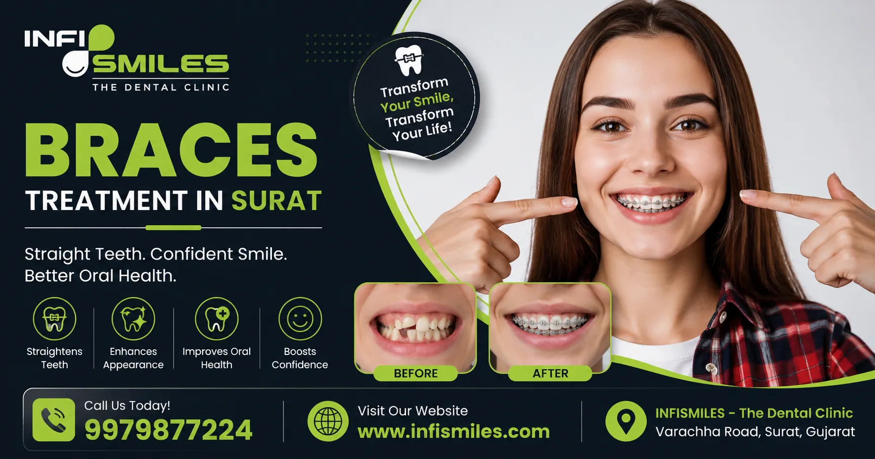 How Braces Treatment in Surat Helps Improve Smile and Confidence
