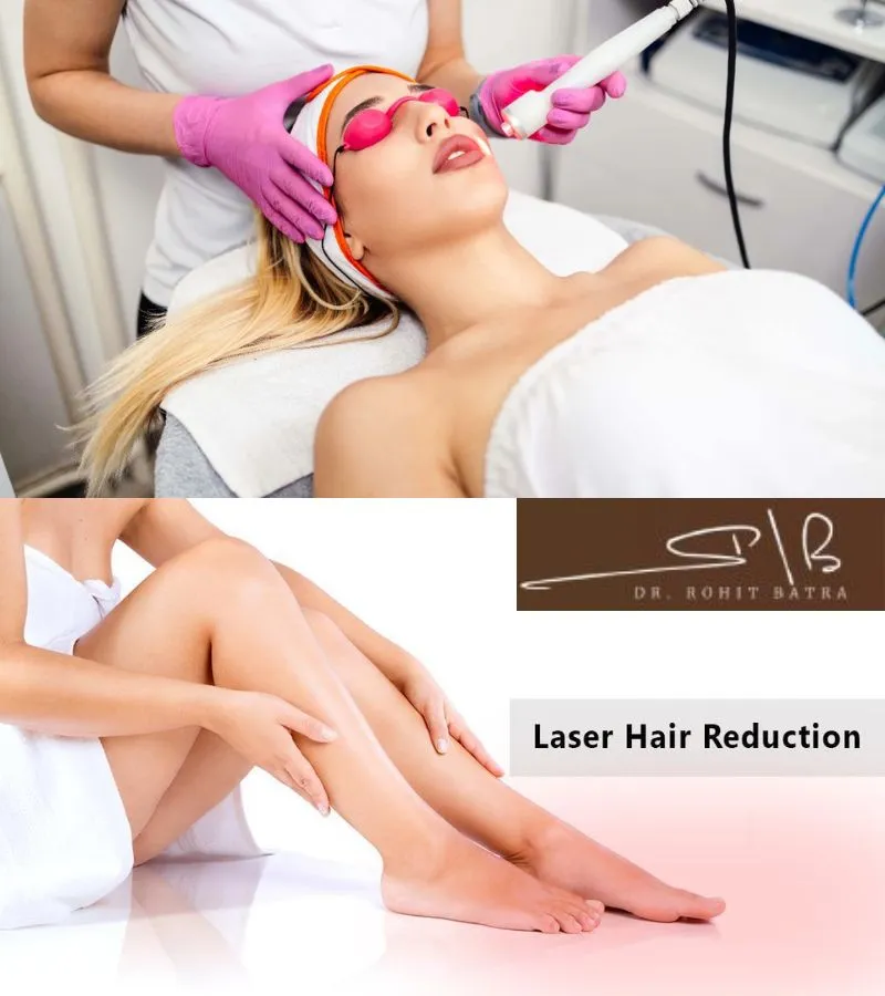 Skin Tones and Hair Colors Role In Laser Hair Reduction