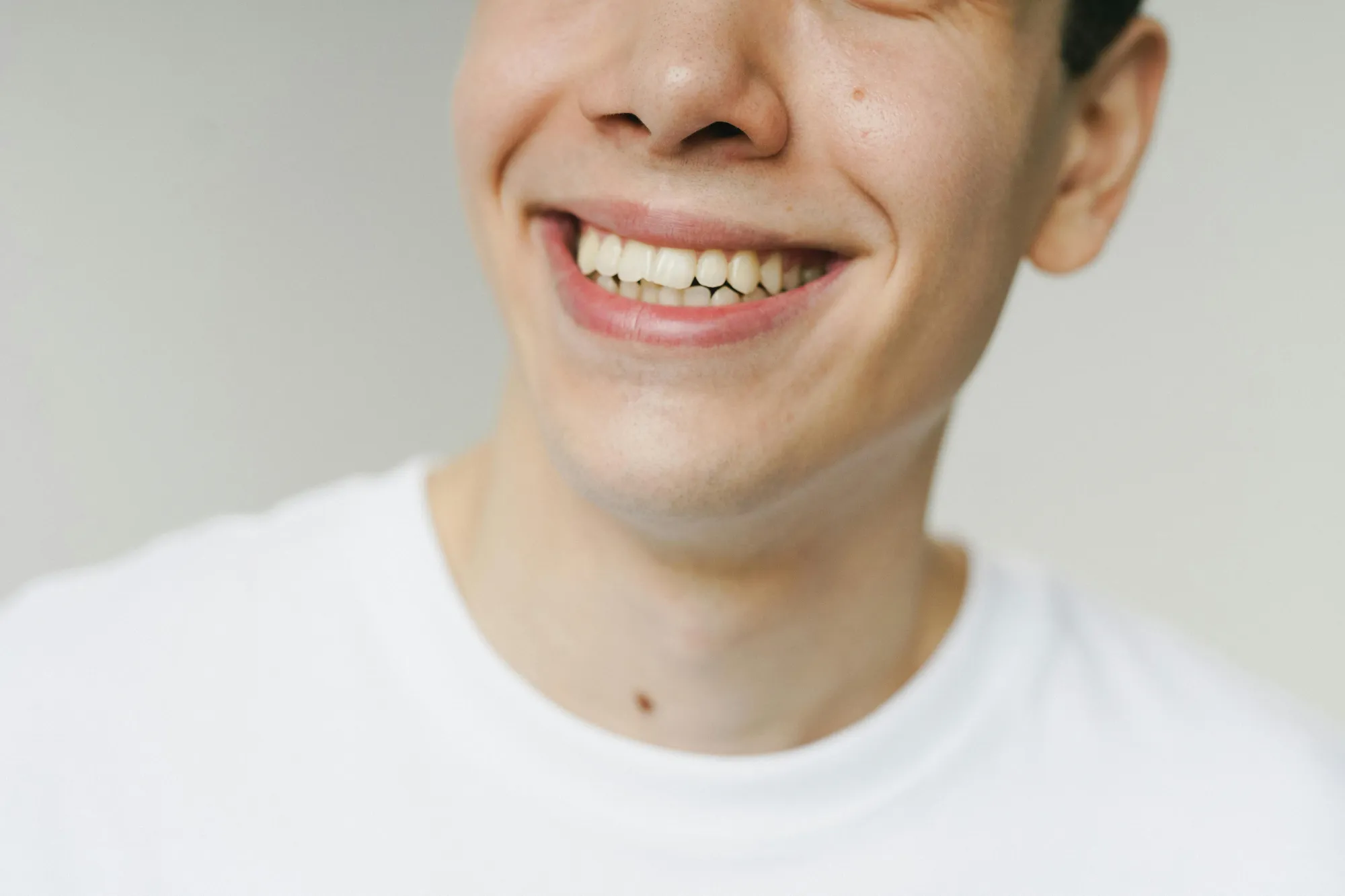 Why UK Patients Choose Veneers in Antalya for Cosmetic Dentistry?