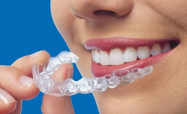Affordable Invisalign Forest Hills Nyc Treatments With Stunning Results - A Complete Guide