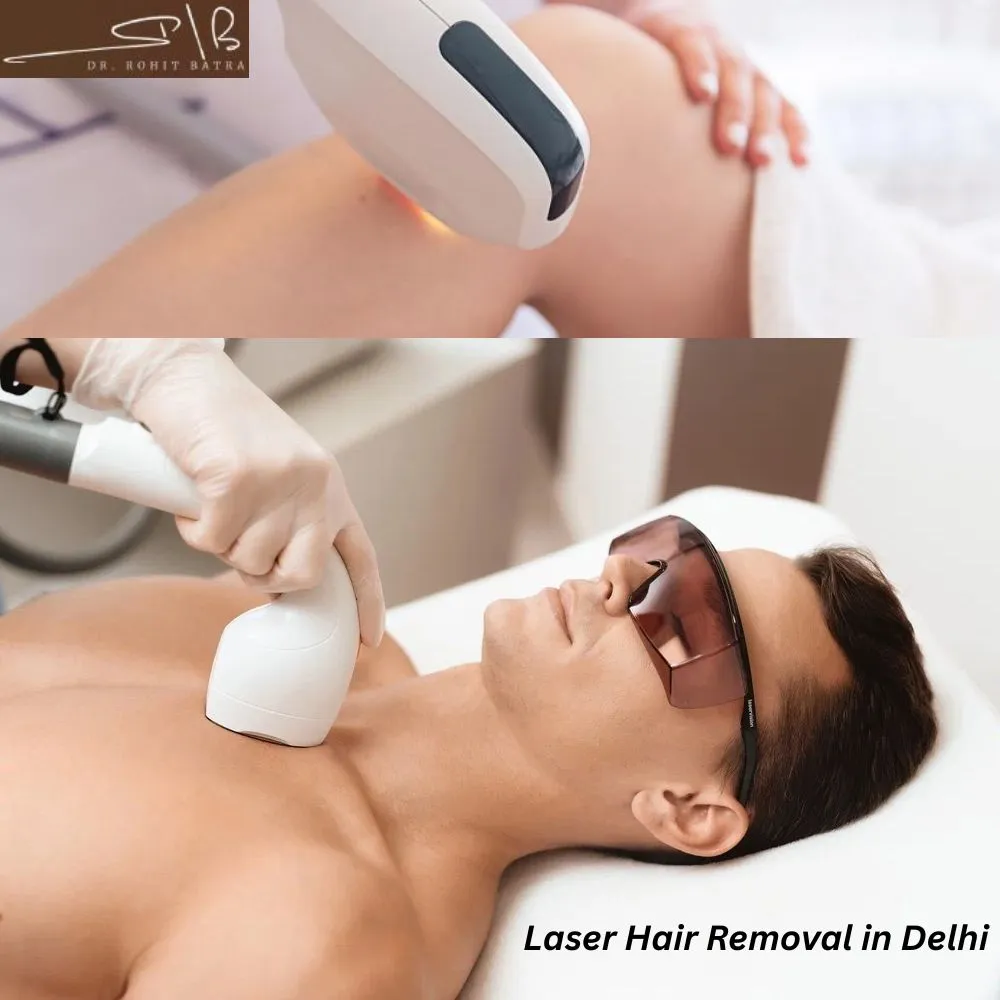 Tired of Waxing Every Month? Here’s What You Should Know About Laser Hair Removal