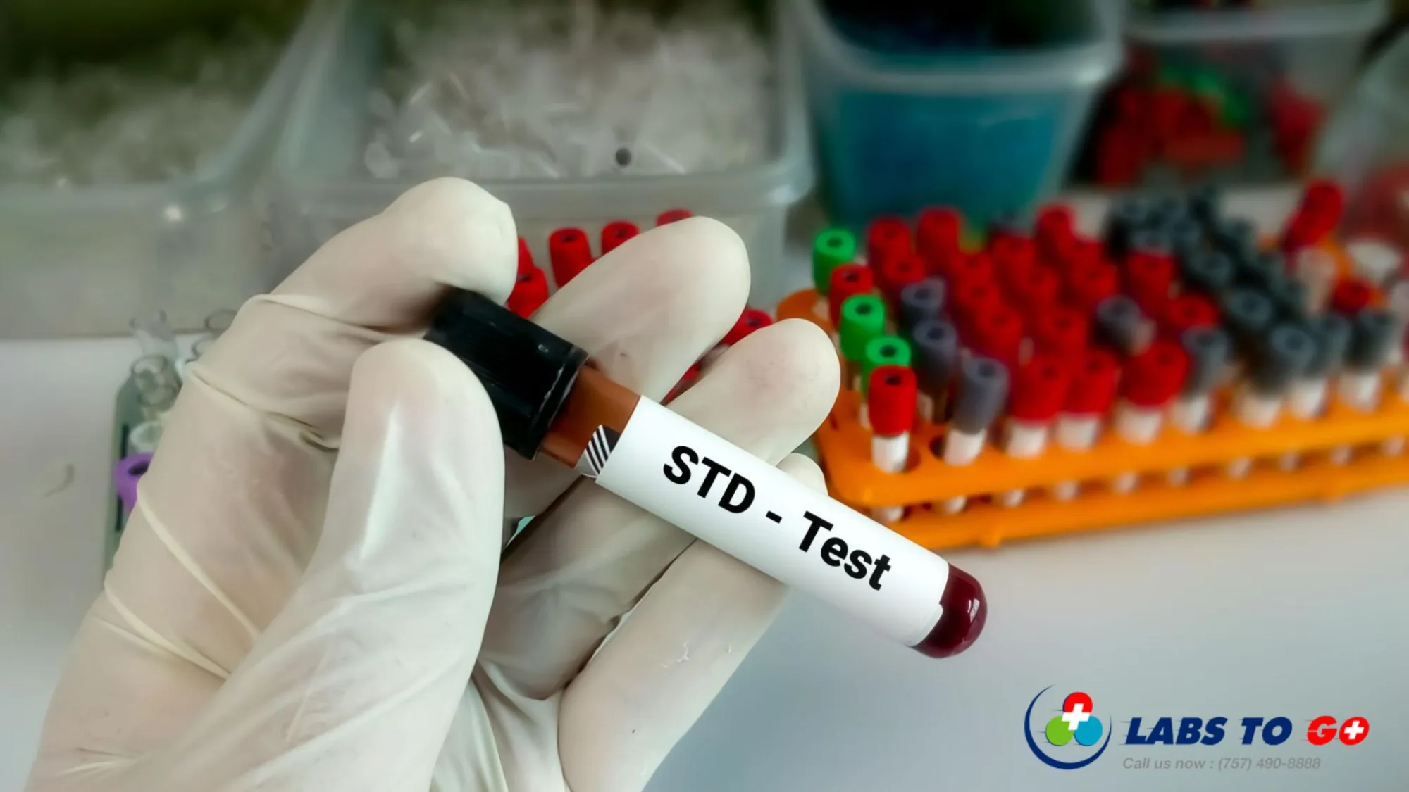 What Happens During an STD Test?