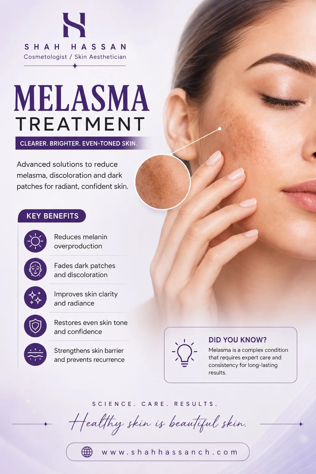 MELASMA EXPERT IN BANI GALA – Advanced Care for Stubborn Skin Pigmentation