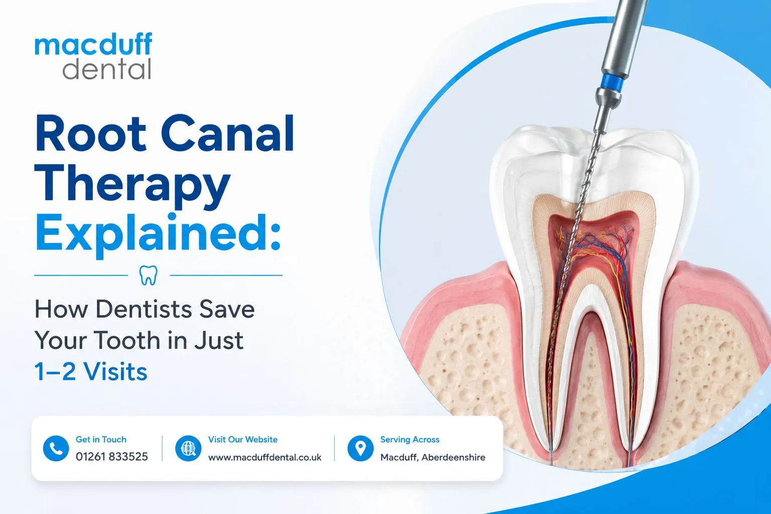 Root Canal Therapy Explained: How Dentists Save Your Tooth in Just 1–2 Visits