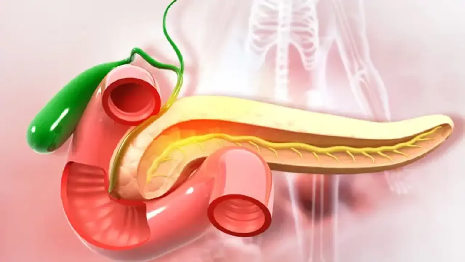 Whipple Surgery (Pancreaticoduodenectomy) in India