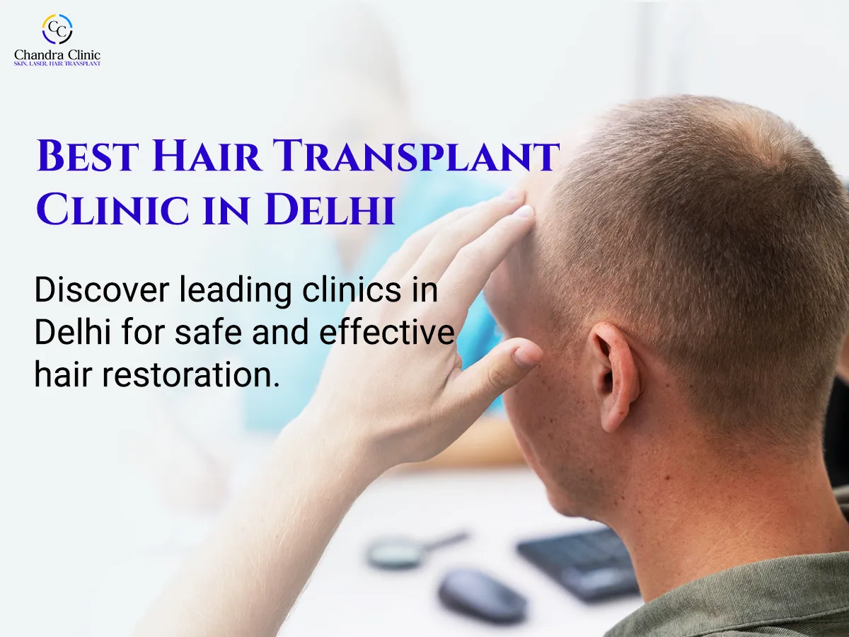 Hair Transplant in Delhi — What You Should Know Before Taking the Decision