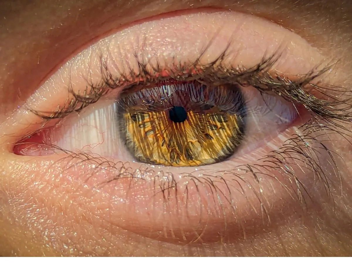 How Refractive Cataract Surgery Redefines Life After 50