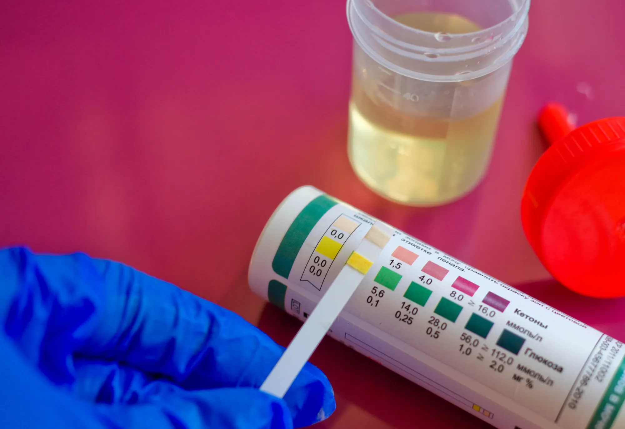 How Pre Employment Drug Screening Works for New Hires