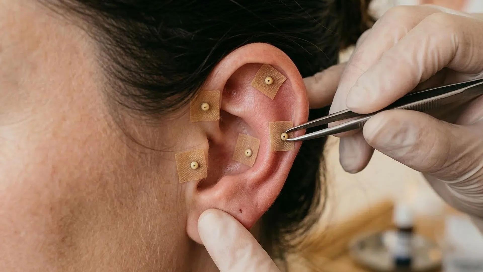 Ear Seeds for Stress Relief and Better Sleep