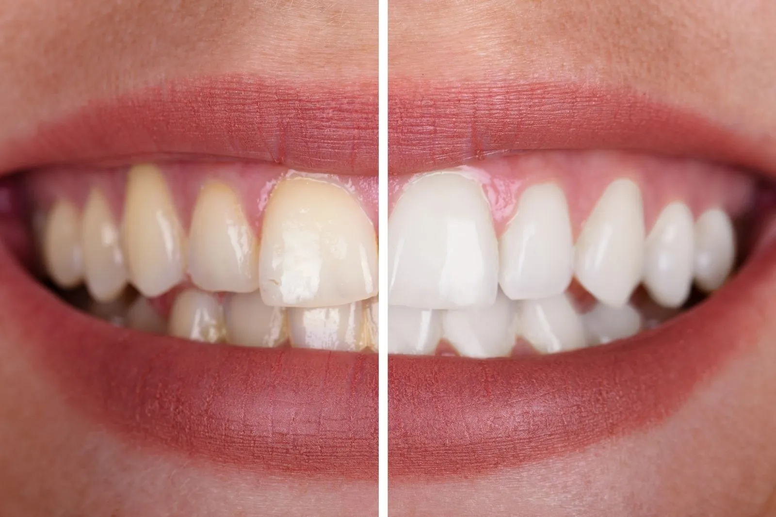 Why Regular General Dentistry Is Essential for Long-Term Oral Health