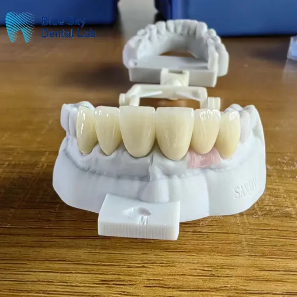 How Dental Implant Solutions Improve Oral Health and Confidence?