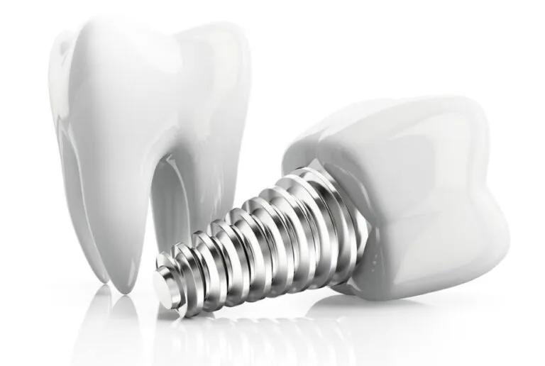 Cómo Elegir una Clínica Dental de Confianza para una Sonrisa Saludable