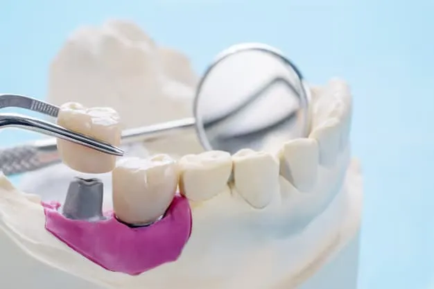 Dental Crowns Lake Mary for Cracked or Worn Teeth