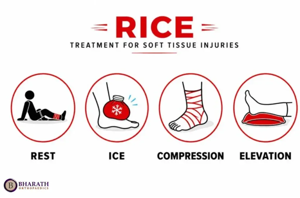 Soft Tissue Injuries: Causes, Symptoms, Treatment, and Recovery