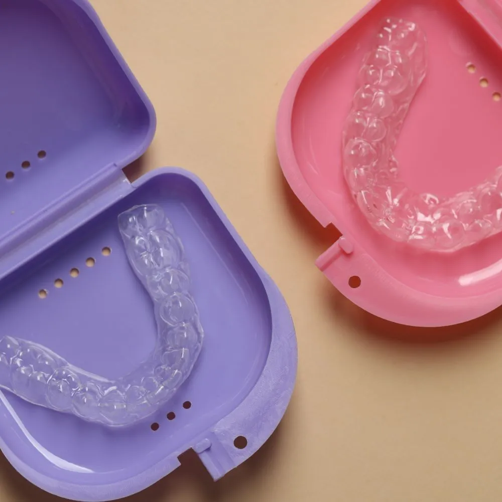 12 Frequently Asked Questions About Retainers Answered