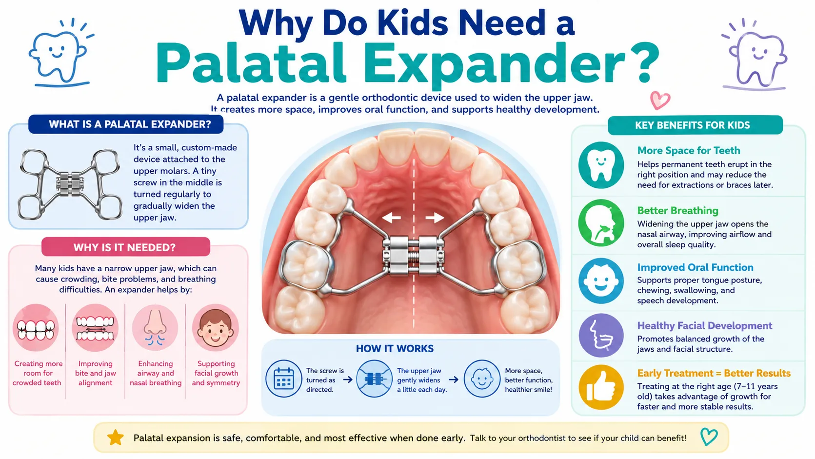 Invisalign Palatal Expander