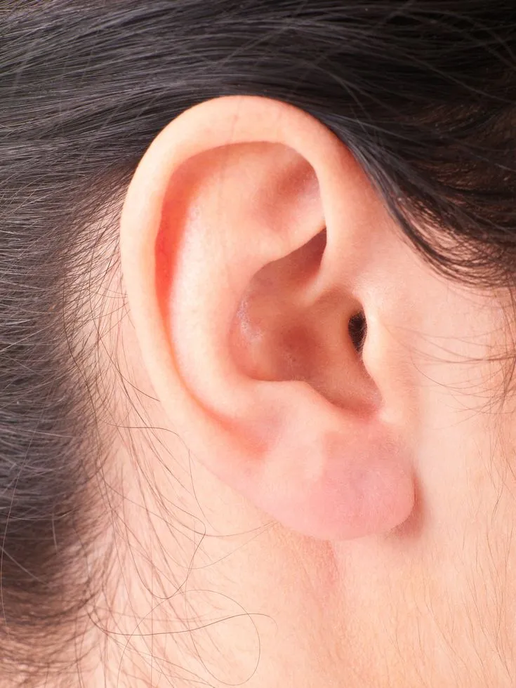 Ear reshaping in Dubai: Achieve Natural Facial Balance