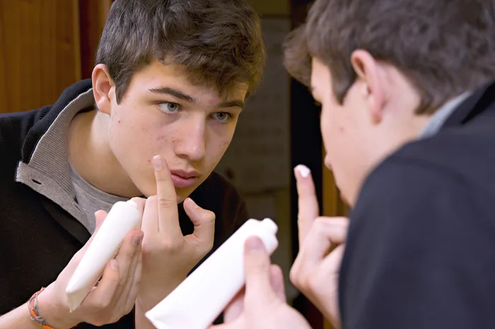 Acne Treatment for Kids and Adults: What Causes Breakouts?