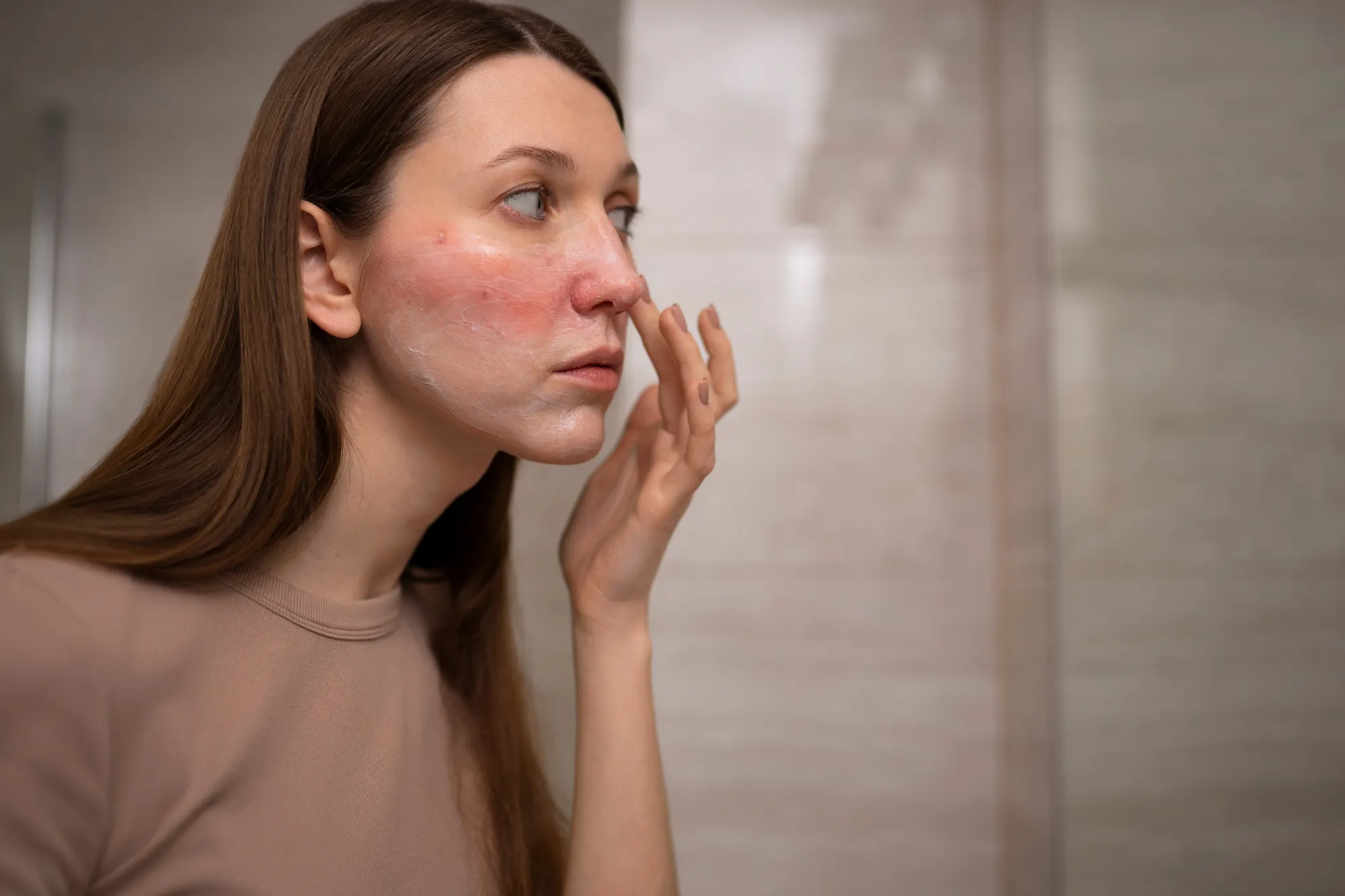 Anti Redness Cream: The Secret to Calm, Healthy-Looking Skin